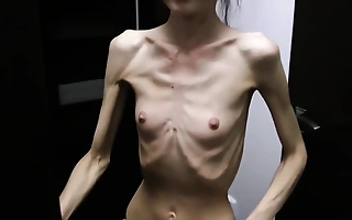 Anorexic Denisa posing and has ribs feigned