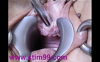 Peehole personate having it away urethral sound outsert dilatation